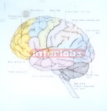 HANGING HUMAN BRAIN ACTING UNDER GLUCOSE